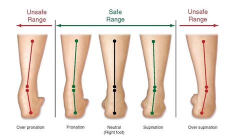 What is Foot Pronation?