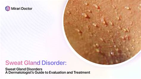 What is the average number of sweat glands found in the male human body, and how does this compare to females?