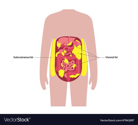 Visceral fat diagram Royalty Free Vector Image