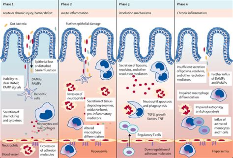 Resolution of inflammation in inflammatory bowel disease - The Lancet Gastroenterology &amp; Hepatology