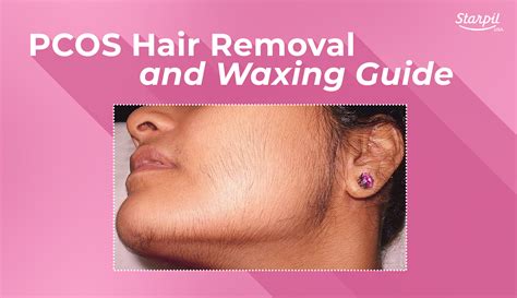 Beyond facial hair, where on the male body does hair growth typically become significantly more prominent during puberty?