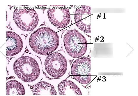 cross section of seminiferous tubules at 400x Diagram | Quizlet