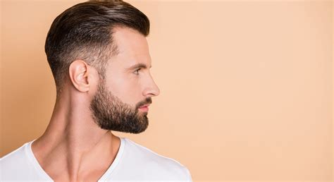 What are the typical patterns and distribution of facial hair growth in adult men?