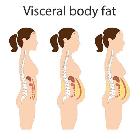 How does the typical distribution of body fat in men change with age, especially concerning visceral fat accumulation?