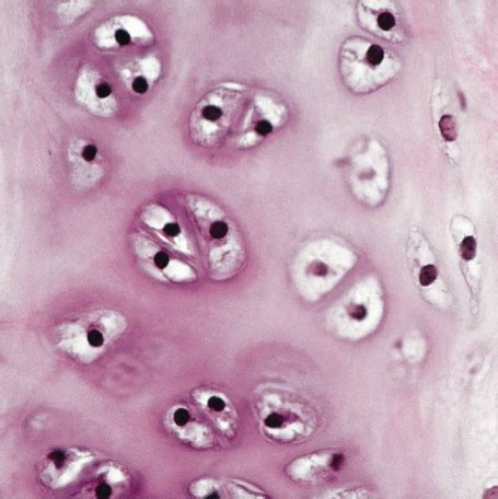 What is the anatomical name for the prominent cartilage that often protrudes from a man’s neck?
