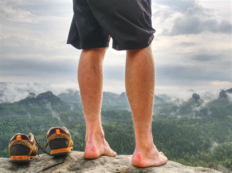 Foot care when hiking