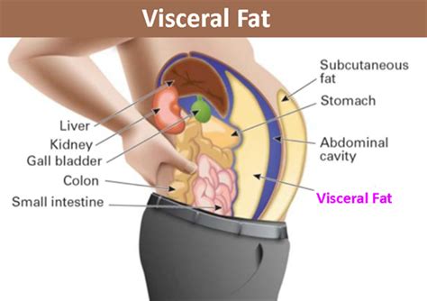 Visceral Fat- Causes, Risks and Ways to Reduce Visceral Fat