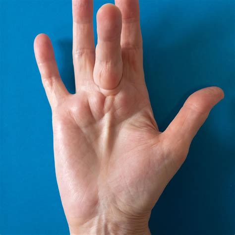 Occupational-Based Hand Therapy. Hand therapy is an occupational ...