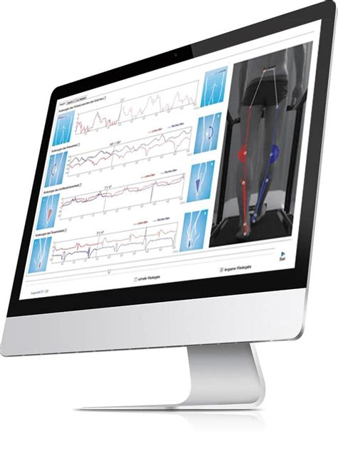 Gait analysis Dublin, Cork, Limerick | Professional, Accurate &amp; Reliable.