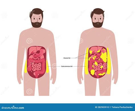 Visceral Fat Diagram Vector Illustration | CartoonDealer.com #281348440