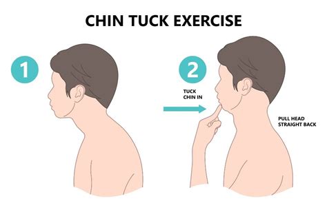 5 Easy Chin Tuck Exercises To Improve Posture And Neck Pain
