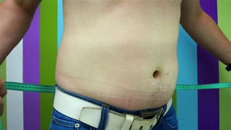 Fat Belly Of Overweight Man Measuring Waistline. Stomach Fat Of Young ...